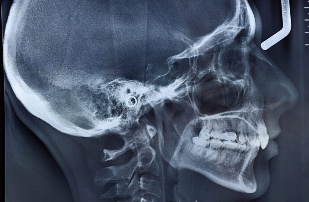 What is TMJ in Tulsa OK
